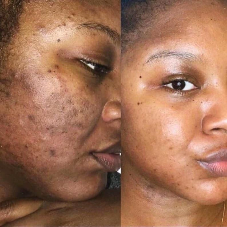 SkinHaven Glow & Clear Kit